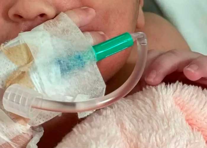 ¡Negligencia! Bebé recibió sutura en cabeza tras caer durante el parto