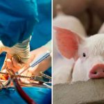 Hombre que recibió corazón de cerdo pudo haber muerto por virus porcino