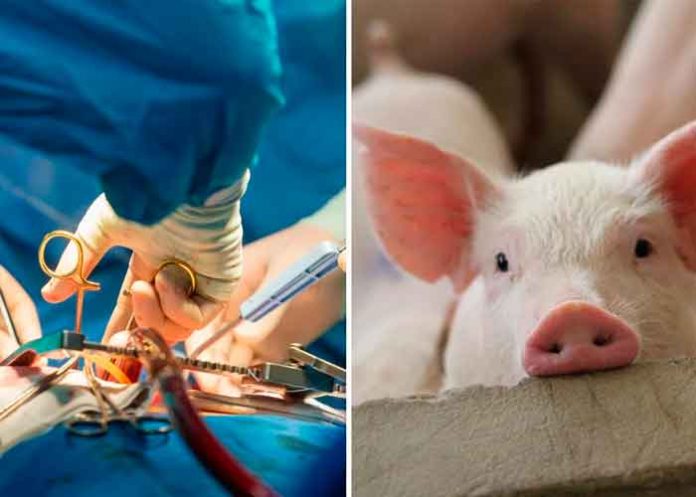 Hombre que recibió corazón de cerdo pudo haber muerto por virus porcino