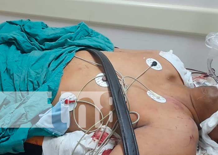 Accidente y asalto deja personas heridas en Jinotega
