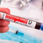 Cuatro casos sospechosos de hepatitis aguda en niños reportan en Portugal