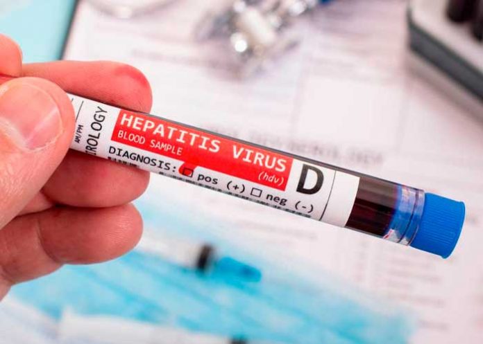 Cuatro casos sospechosos de hepatitis aguda en niños reportan en Portugal
