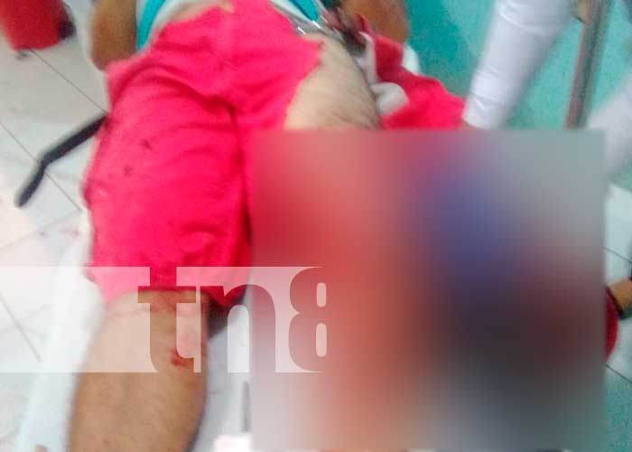 Motociclistas lesionados en el municipio de Villa Sandino, Chontales