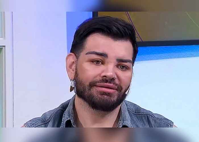 "Gemelo de Ricky Martin": Joven se hace cirugías para igualar al artista