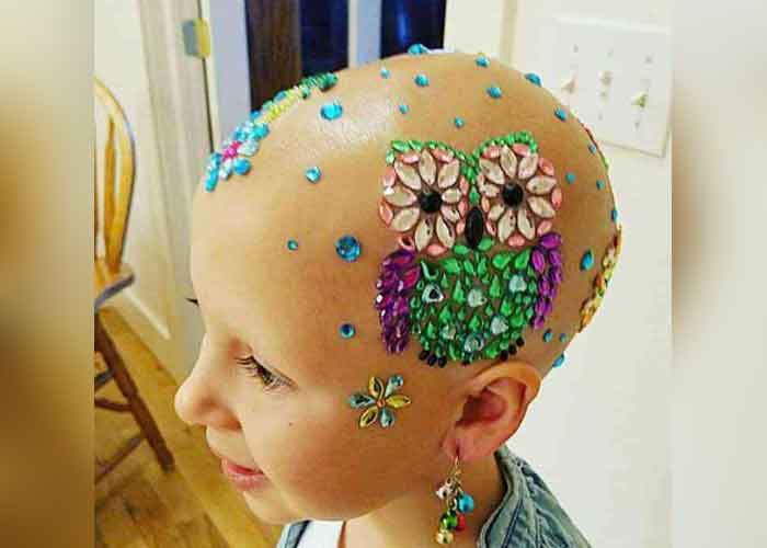"Día del pelo loco": Niña con alopecia gana concurso escolar