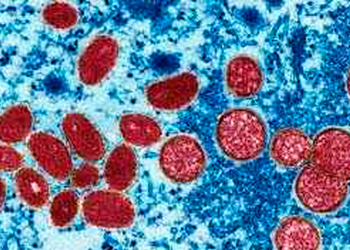 3,400 casos de viruela en lo que va del año según OMS