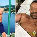 'Exitosa cirugía' le devuelve los brazos a hombre, Francia