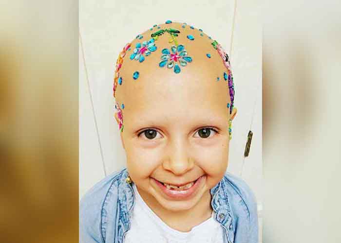 "Día del pelo loco": Niña con alopecia gana concurso escolar