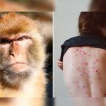 Detectan en EE.UU. dos cepas distintas de viruela del mono