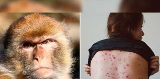Detectan en EE.UU. dos cepas distintas de viruela del mono