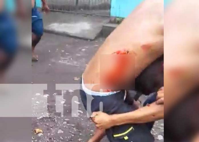 Pleito vecinal en la Isla de Ometepe deja a 2 personas heridas