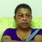Mujer que sufrió golpes y agresión por parte de un sacerdote en Nandaime