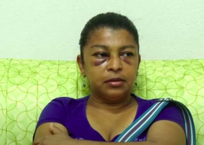 Mujer que sufrió golpes y agresión por parte de un sacerdote en Nandaime