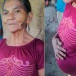 ¡Estaba menstruando! A sus 62 años hondureña afirma estar embarazada