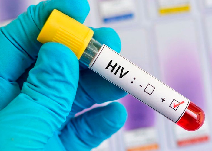 Acuerdo internacional facilitará el primer inyectable preventivo del VIH