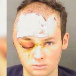Un policía de Florida dispara en la cabeza al secuestrador de su terapeuta