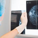 Inteligencia Artificial con alta tasa de éxito para detectar el cáncer de mama