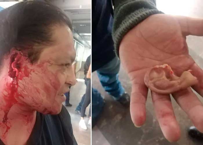 Por andar de "viejo rabo verde" le arrancan la oreja en el metro de México