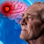 Ancianitos que tuvieron Covid-19 con mayor riesgo de padecer Alzheimer