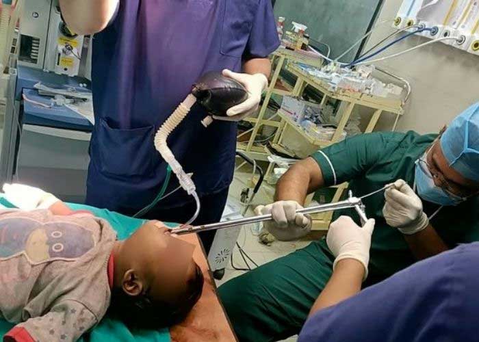 ¡Viva de milagro! Bebé se traga cortauñas por accidente en la India