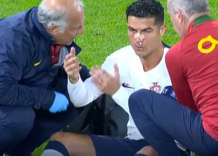 ¡Bañado en sangre! Cristiano Ronaldo queda tendido en el campo