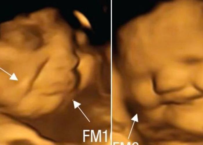 Fotos de fetos que reacciona según lo que coma mamá