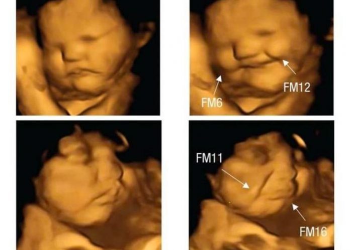 Fotos de fetos que reacciona según lo que coma mamá