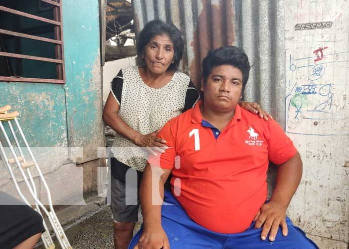 Una historia de susto fue la de un hombre que fue impactado por un rayo en Managua