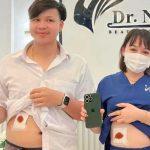 Polémica promoción en Tailandia "un riñón por un iPhone" ¿Te atreverías?