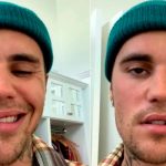 Justin Bieber cancela 28 conciertos por el avance del Síndrome que padece