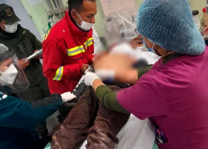 Le desfigura la cara a machetazo a su hijo en un ataque de ira en Bolivia