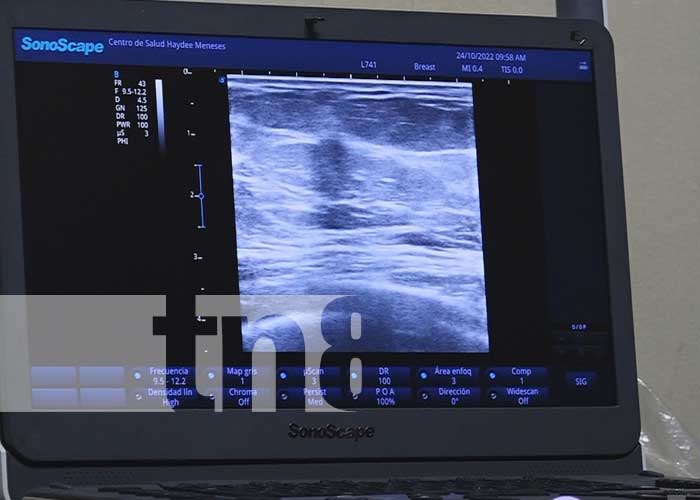 Exámenes gratuitos de mamografías para mujeres en Palacagüina
