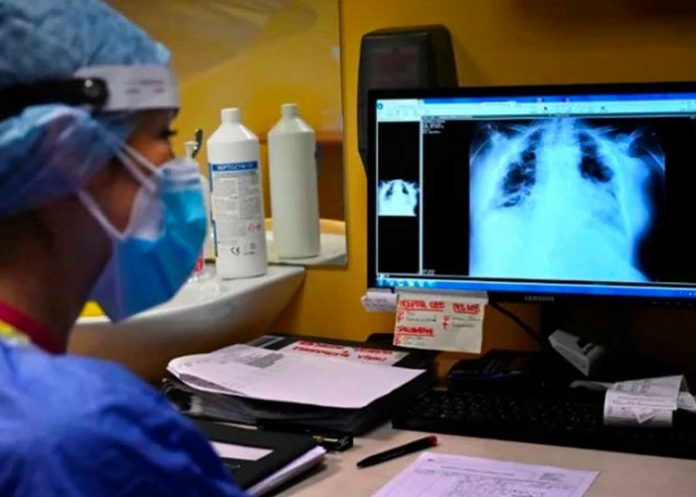 La tuberculosis vuelve a propagarse, advierte la OMS