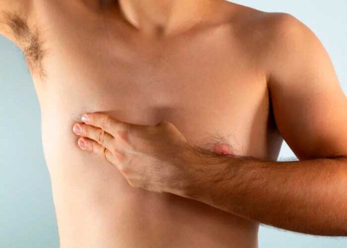 Cáncer de mama en hombres: Estos son los síntomas de alerta