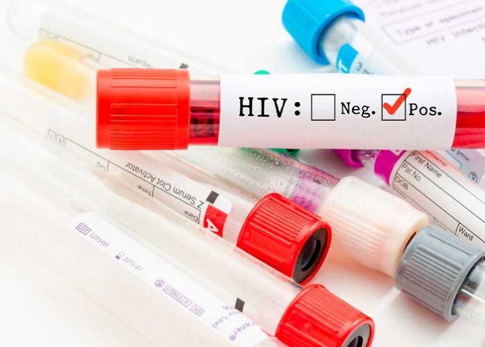 La cura del VIH cada vez más cerca mediante terapia génica