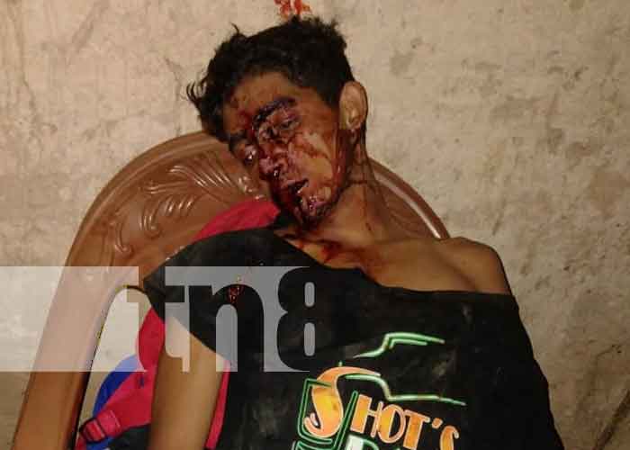 Mujer y hombre atacan con arma blanca a joven en Jalapa