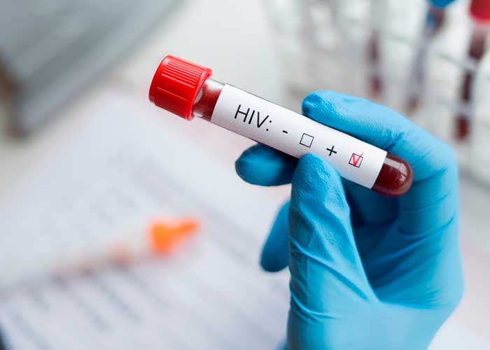 La cura del VIH cada vez más cerca mediante terapia génica