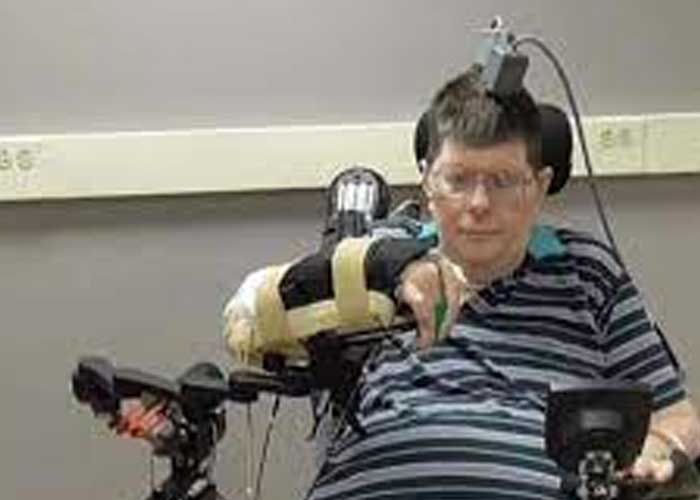 ¡Impresionante! Neuroprótesis permite a hombre paralizado comunicarse