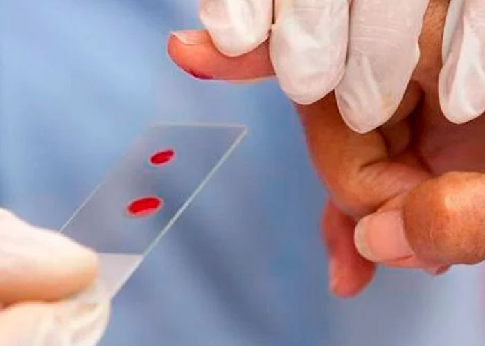 Aprueban el medicamento más caro del mundo para tratar la Hemofilia B