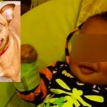 Bebé es atacado por pitbulls en Washington