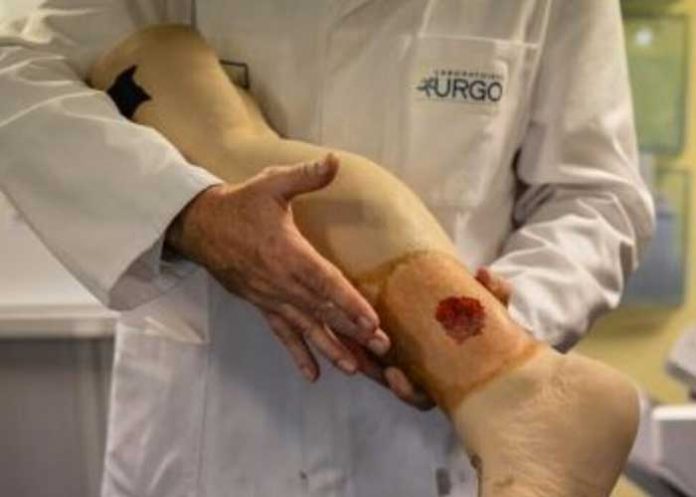 Artificial Skin Designed To Heal Severe Burns