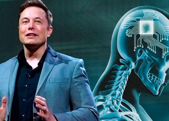 Elon Musk implantará "Neuralink" dentro del cerebro humano en seis meses