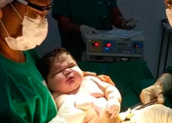 Nace bebé con más de 7 kilos y rompe récord en Brasil