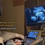 Bebé se vuelve viral por salir “cantando” en el ultrasonido