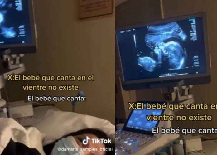 Bebé se vuelve viral por salir “cantando” en el ultrasonido
