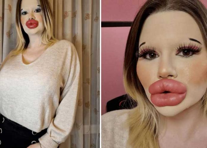Fotos: Mujer con enormes labios planea batir “otro récord” corporal
