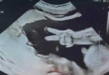 Bebé sorprende a sus papás con la señal de amor y paz en ultrasonido