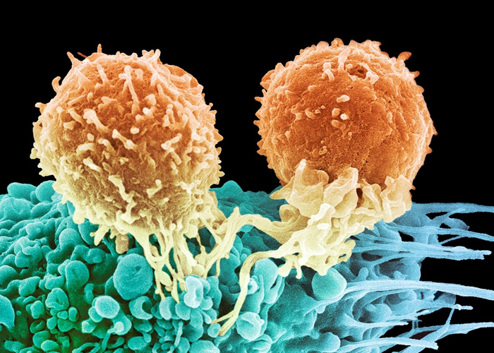 Investigación resalta como el cáncer se "protege" de la quimioterapia