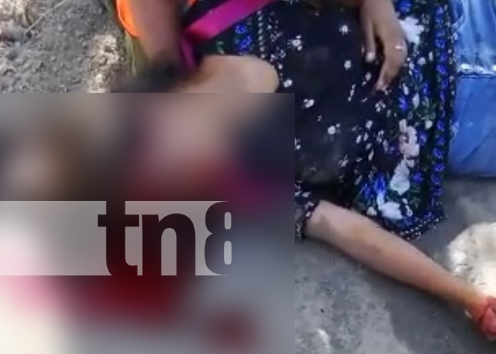 Foto: Adolescente grave en accidente de tránsito en El Jícaro, en Nueva Segovia / TN8