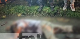 Hombre grave tras ser arrollado por un vehículo en Villa Sandino, Chontales